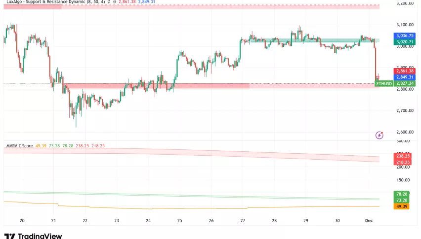 Ethereum subvaluado: estudio revela posible alza del 58% en su valoración
